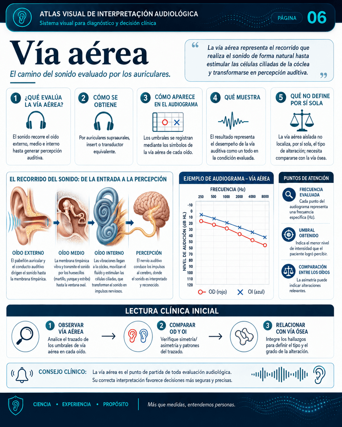Muestra real del Sistema Visual de Interpretación Audiológica